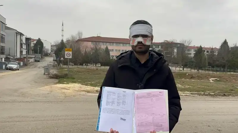 Öğretmen Krizi: Yüzüne Sıcak Çay Fırlatan Hadise Okulda Şok Etti