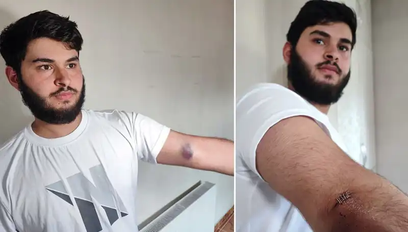Bahçeye Kaçan Top Mahallede Karışıklık Yarattı, Conolar Kamyonetle Geldi!